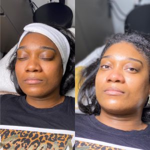 Luxury Package Facial